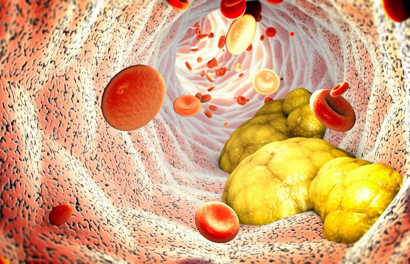 Skąd się bierze cholesterol we krwi?